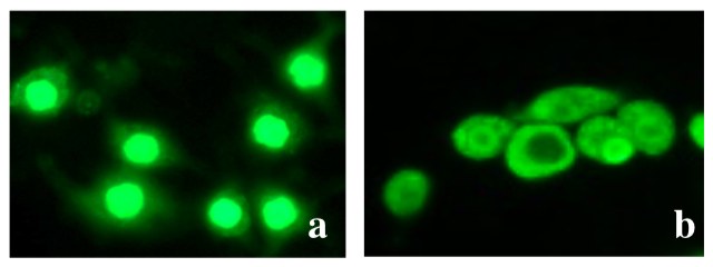Fluorescensmikroskopibilder av proteinet HMGB1